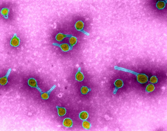 Framed Print : Rauscher Leukemia Virus, TEM Framed Print : Rauscher Leukemia Virus, TEM