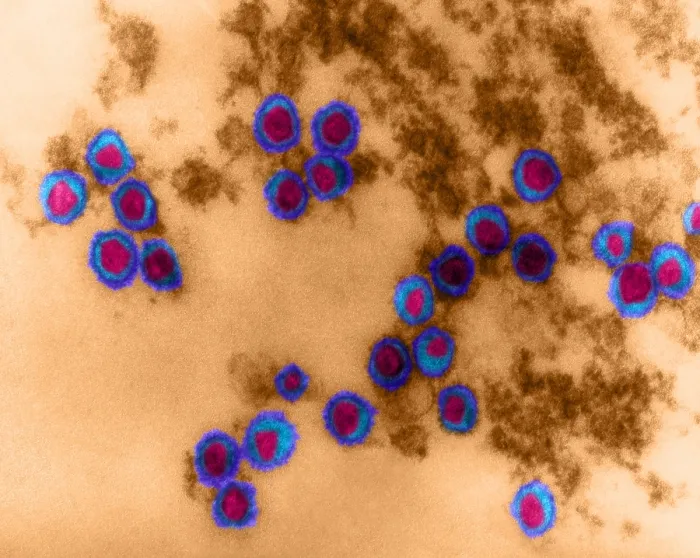 Framed Print : Rauscher Leukemia Virus, TEM Framed Print : Rauscher Leukemia Virus, TEM
