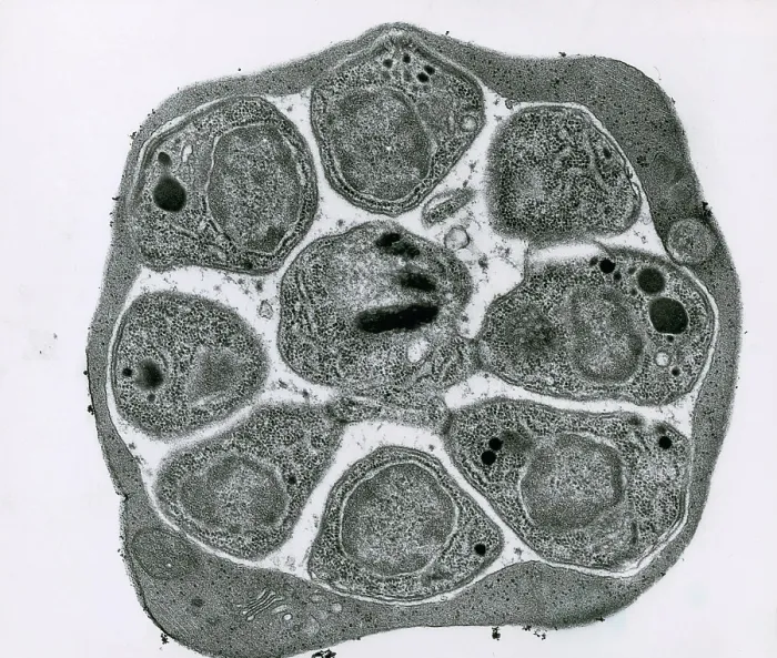 Framed Print : RBC Infected with Malarial Parasite, TEM Framed Print : RBC Infected with Malarial Parasite, TEM