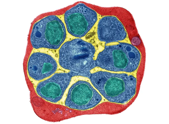 Framed Print : RBC Infected with Malarial Parasite, TEM