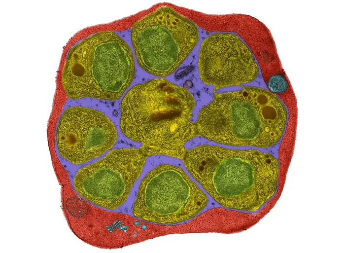 Framed Print : RBC Infected with Malarial Parasite, TEM