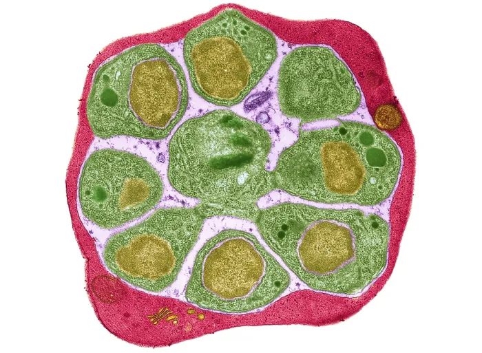 Framed Print : Red blood cell Infected with Malarial Parasite, under a transmission electron microscope TEM Framed Print : Red blood cell Infected with Malarial Parasite, under a transmission electron microscope TEM