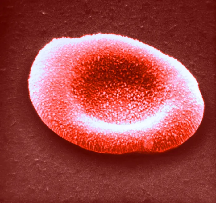 Framed Print : Red Blood Cell, under a microscope (SEM) Framed Print : Red Blood Cell, under a microscope (SEM)