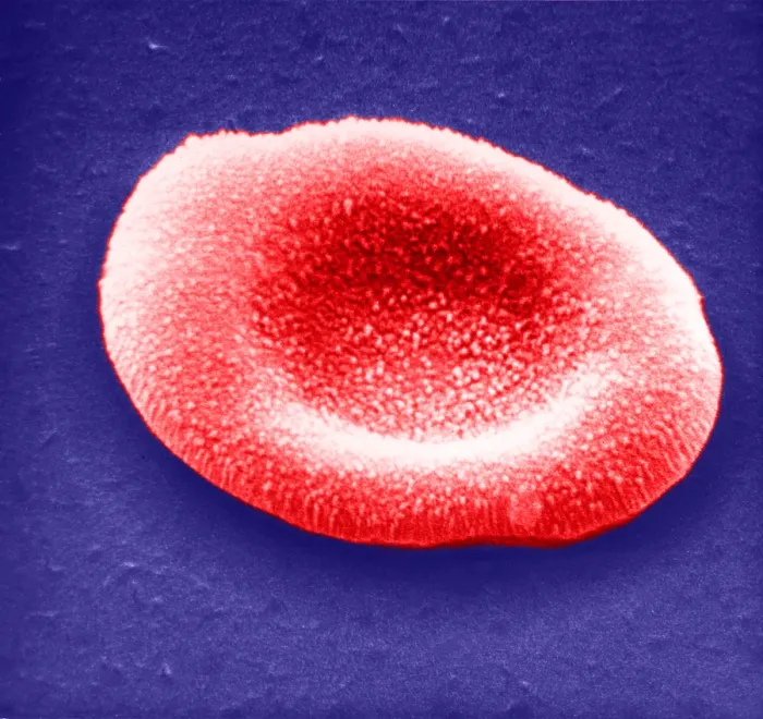 Framed Print : Red Blood Cell, under a microscope (SEM)