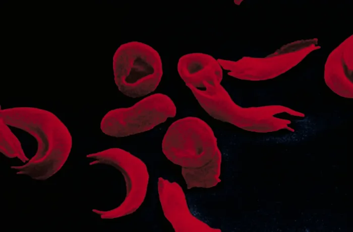 Framed Print : Red blood cells Framed Print : Red blood cells