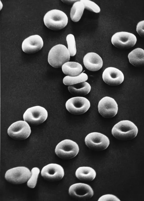 Framed Print : Red Blood Cells, under a microscope (SEM) Framed Print : Red Blood Cells, under a microscope (SEM)