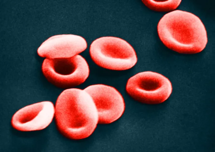 Framed Print : Red Blood Cells, under a microscope (SEM) Framed Print : Red Blood Cells, under a microscope (SEM)