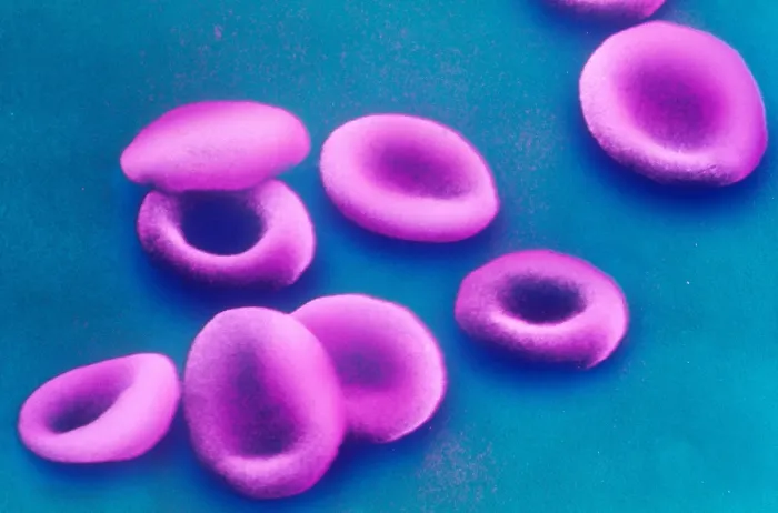 Framed Print : Red Blood Cells, under a microscope (SEM) Framed Print : Red Blood Cells, under a microscope (SEM)