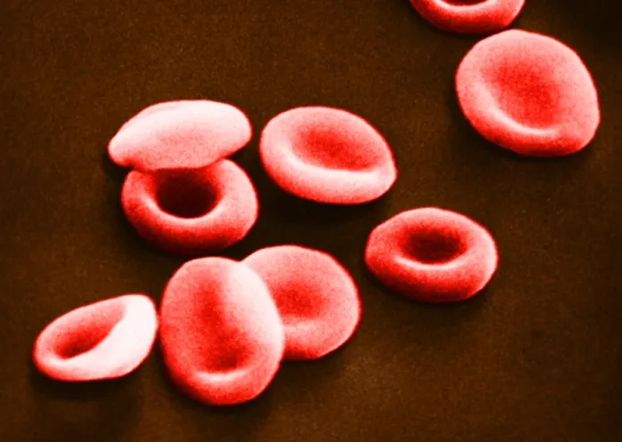 Framed Print : Red Blood Cells, under a microscope (SEM) Framed Print : Red Blood Cells, under a microscope (SEM)