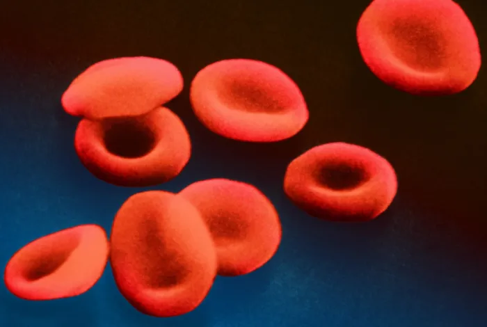 Framed Print : Red Blood Cells, under a microscope (SEM) Framed Print : Red Blood Cells, under a microscope (SEM)