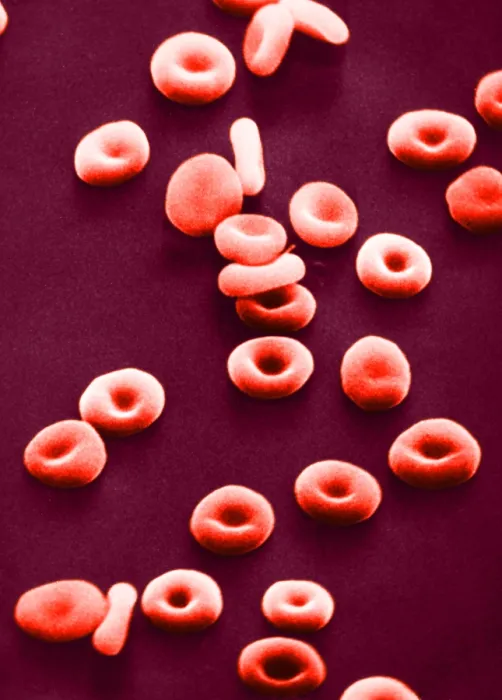 Framed Print : Red Blood Cells, under a microscope (SEM) Framed Print : Red Blood Cells, under a microscope (SEM)