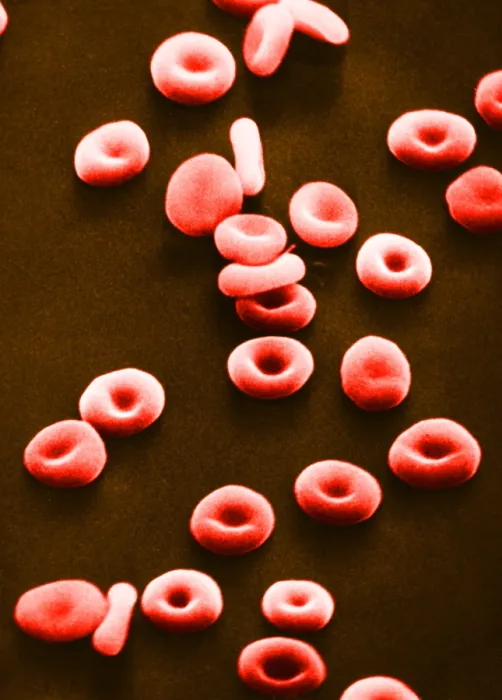 Framed Print : Red Blood Cells, under a microscope (SEM) Framed Print : Red Blood Cells, under a microscope (SEM)