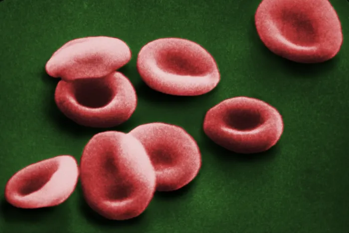 Framed Print : Red Blood Cells, under a microscope (SEM) Framed Print : Red Blood Cells, under a microscope (SEM)