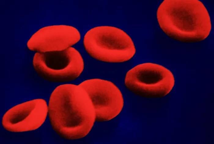Framed Print : Red Blood Cells, under a microscope (SEM) Framed Print : Red Blood Cells, under a microscope (SEM)
