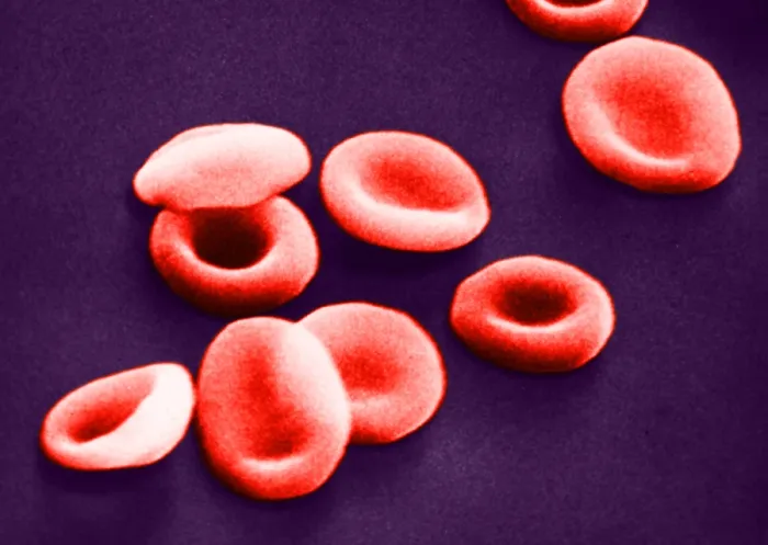 Framed Print : Red Blood Cells, under a microscope (SEM) Framed Print : Red Blood Cells, under a microscope (SEM)