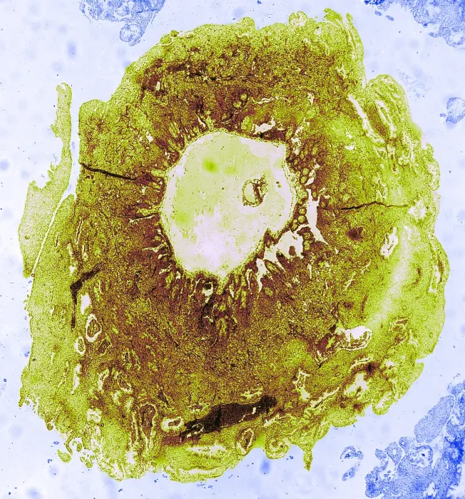 Framed Print : Reproduction System, Human Ovum, TEM