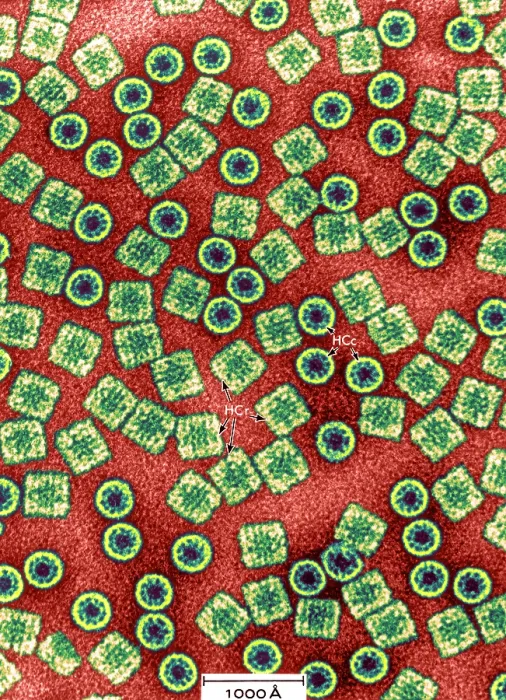 Framed Print : Respiratory Protein, Hemocyanin, TEM Framed Print : Respiratory Protein, Hemocyanin, TEM