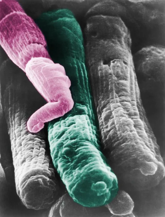 Framed Print : Rods and Cones, under a microscope (SEM)
