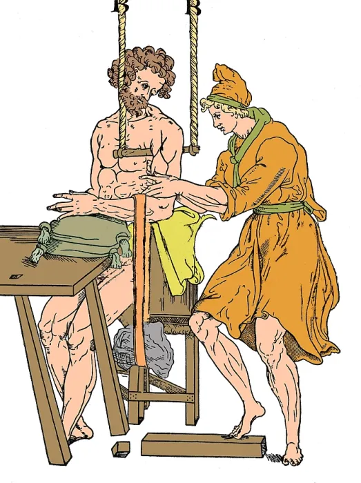 Framed Print : Roman Devices for Setting Fractures Framed Print : Roman Devices for Setting Fractures
