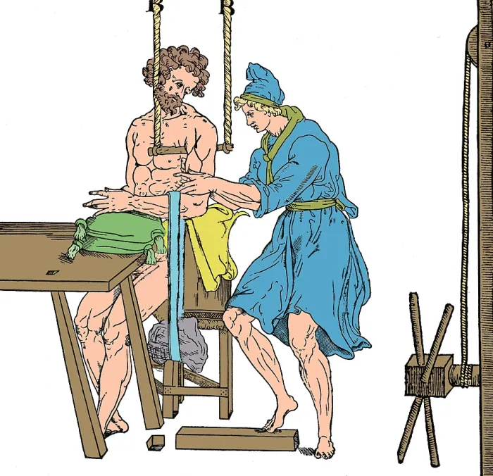 Framed Print : Roman Devices for Setting Fractures