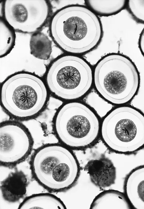 Framed Print : Roundworm mitosis Framed Print : Roundworm mitosis