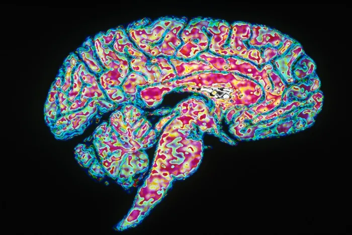 Framed Print : Sagittal Section of Brain Framed Print : Sagittal Section of Brain
