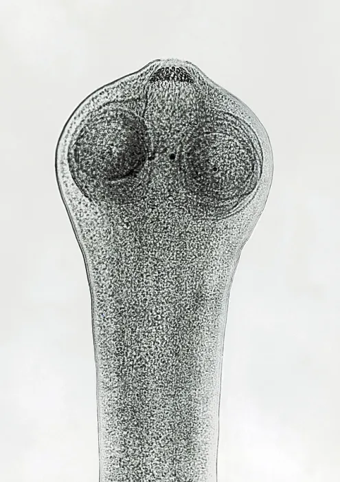 Framed Print : Scolex of a Tapeworm (Dipylidium sp.) under a microscope Framed Print : Scolex of a Tapeworm (Dipylidium sp.) under a microscope