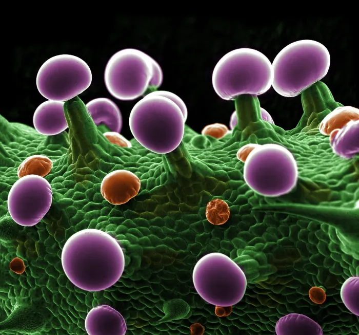 Framed Print : SEM Cannabis Trichomes Framed Print : SEM Cannabis Trichomes
