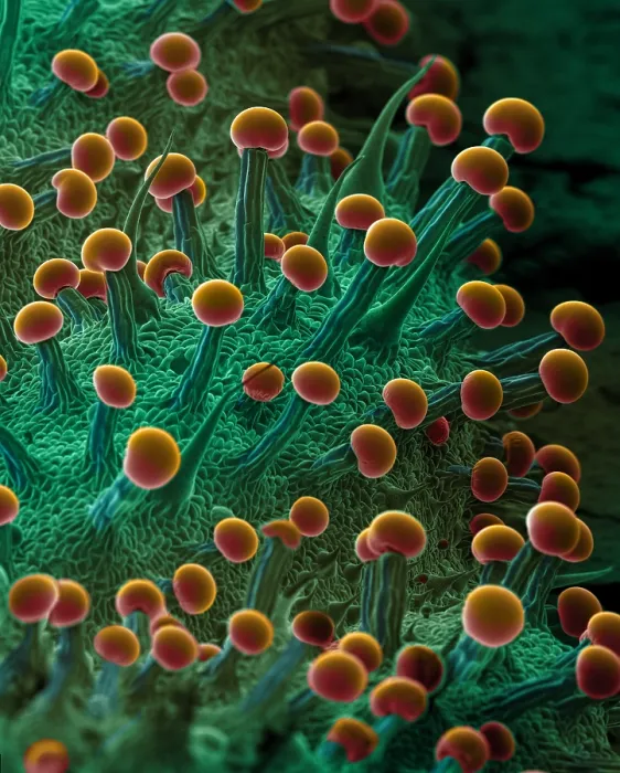 Framed Print : SEM Cannabis Trichomes Framed Print : SEM Cannabis Trichomes