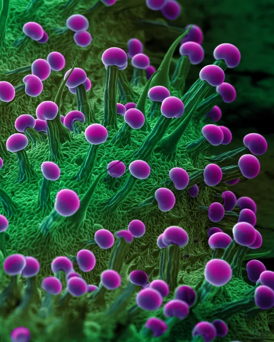 Framed Print : SEM Cannabis Trichomes Framed Print : SEM Cannabis Trichomes