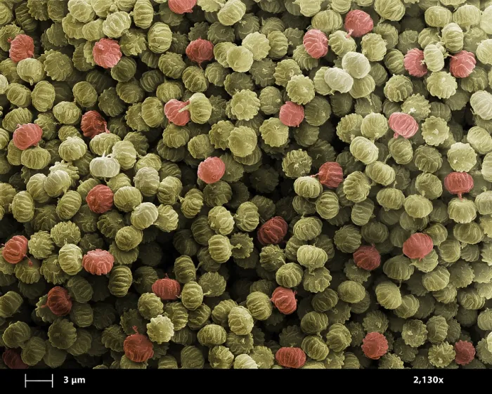 Framed Print : SEM of Ergot