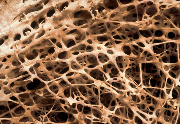 Framed Print : Shin Connecting Bones SEM