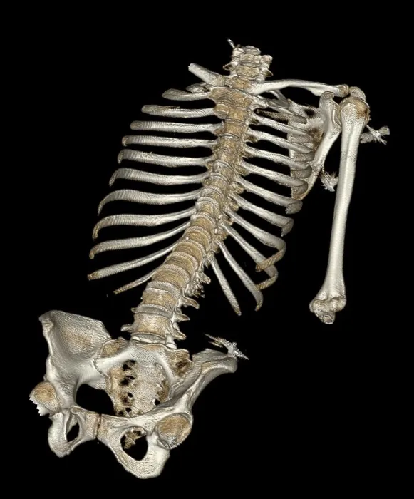 Framed Print : Skeletal Reconstruction Framed Print : Skeletal Reconstruction