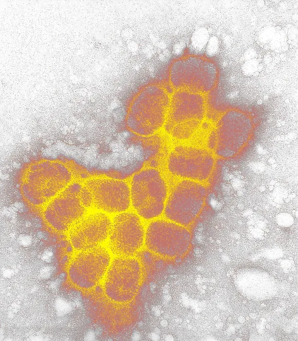 Framed Print : Smallpox virus Framed Print : Smallpox virus
