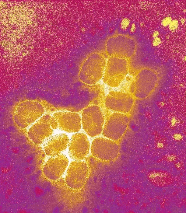 Framed Print : Smallpox virus