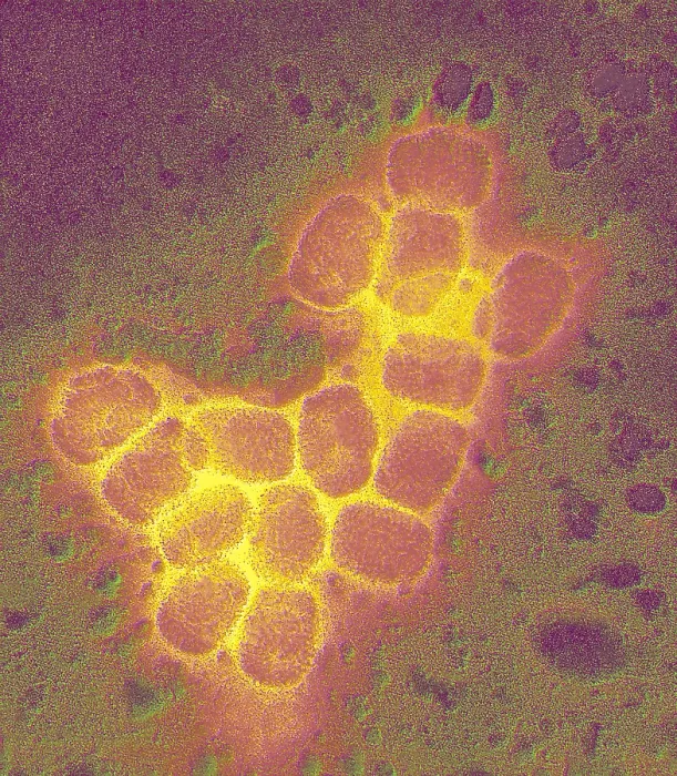 Framed Print : Smallpox virus