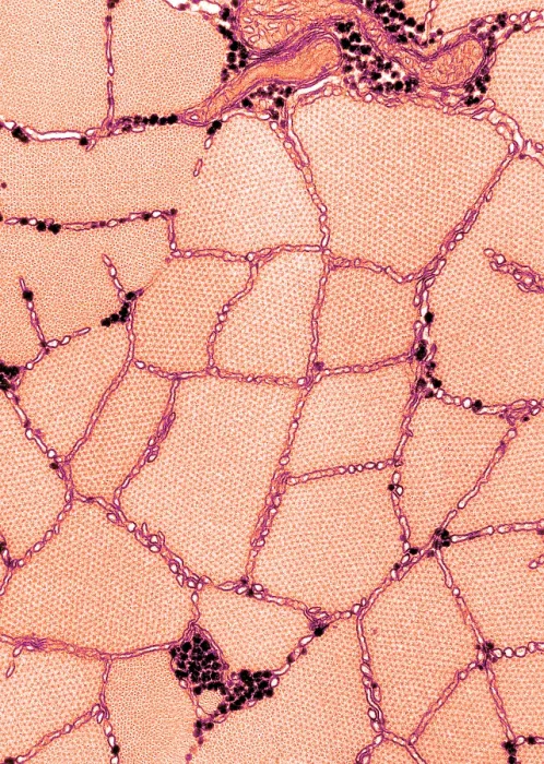 Framed Print : Smooth Muscle, Phasic, TEM Framed Print : Smooth Muscle, Phasic, TEM