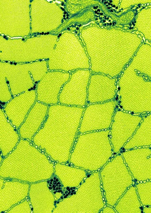 Framed Print : Smooth Muscle, Phasic, TEM Framed Print : Smooth Muscle, Phasic, TEM