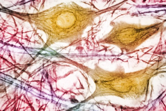 Framed Print : Spinal Cord Motor Cells, light micrograph