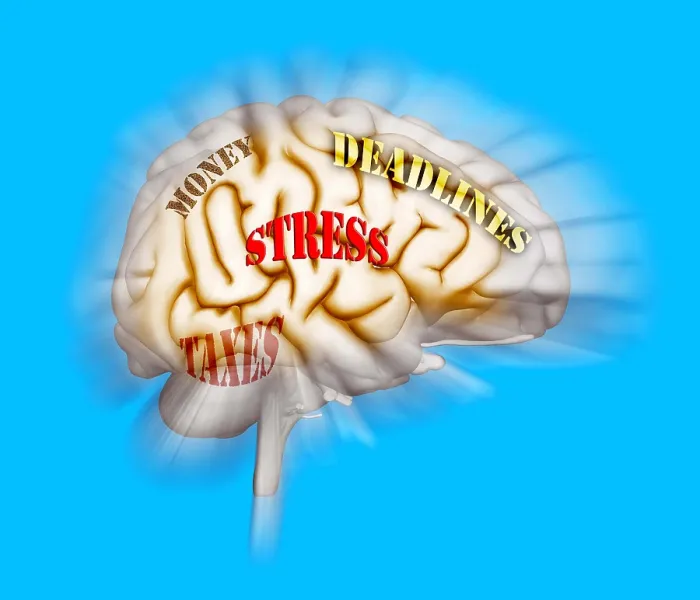 Framed Print : Stress. Illustration of the human brain, and the concept of stress and anxiety
