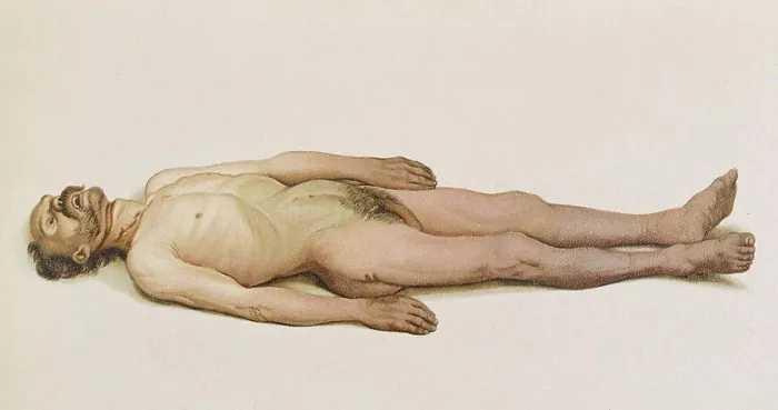 Framed Print : Suicide by Hanging, 1898
