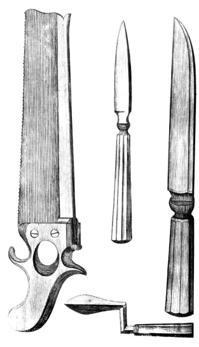 Framed Print : Surgical Instruments, 1791 Framed Print : Surgical Instruments, 1791