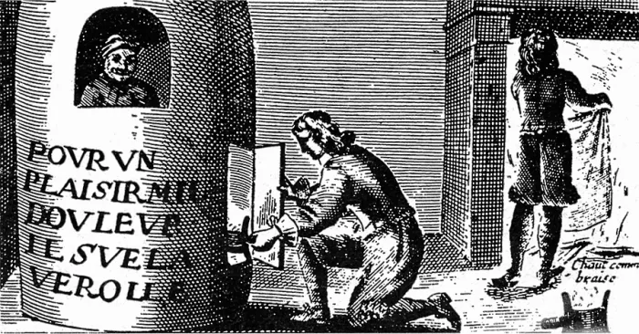 Framed Print : Syphilis Treatment, 16th Century Framed Print : Syphilis Treatment, 16th Century
