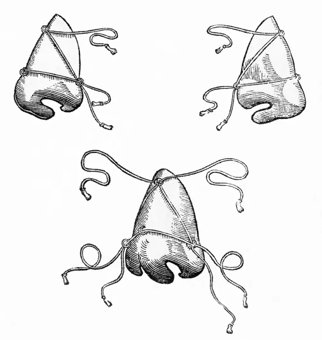Framed Print : Tagliacozzi's Post-Operative Nose Masks, 1500s
