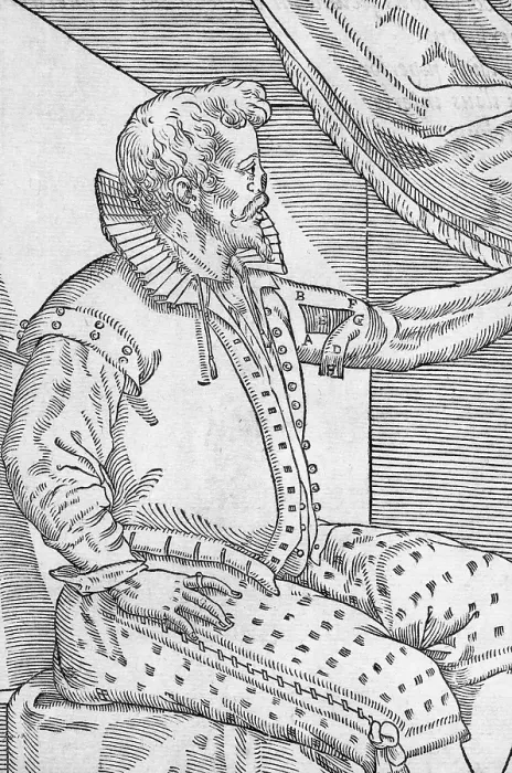 Framed Print : One of Tagliacozzi's Rhinoplasty Methods, 3 of 6