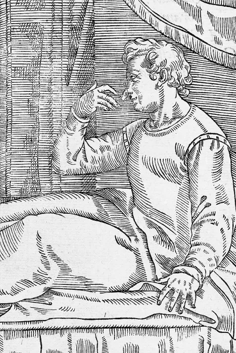 Framed Print : One of Tagliacozzi's Rhinoplasty Methods, 4 of 6 Framed Print : One of Tagliacozzi's Rhinoplasty Methods, 4 of 6