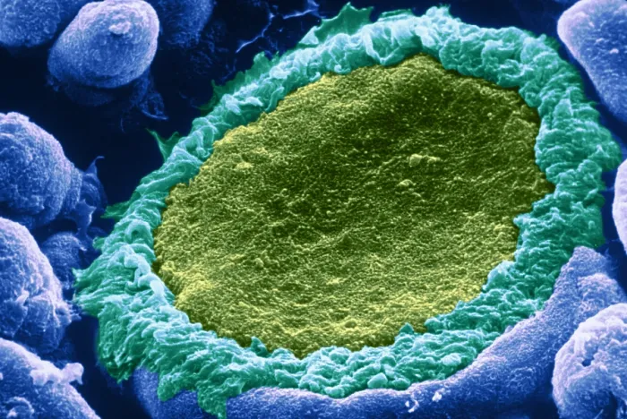 Framed Print : Taste bud. Color enhanced electron micrograph of taste buds; groups of Framed Print : Taste bud. Color enhanced electron micrograph of taste buds; groups of
