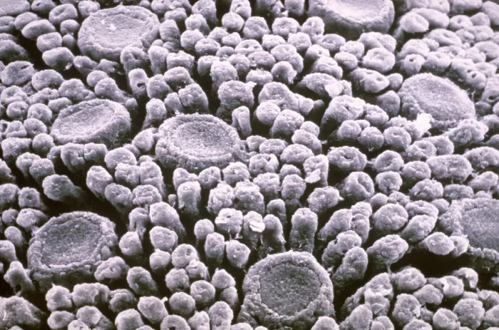 Framed Print : Tastebuds. Scanning electron microscopy of taste buds on the surface of a tongue Framed Print : Tastebuds. Scanning electron microscopy of taste buds on the surface of a tongue