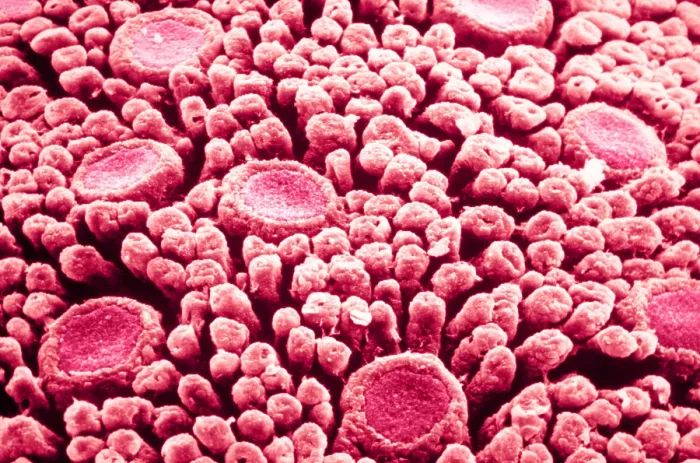 Framed Print : Tastebuds. Color enhanced scanning electron micrograph of taste buds on Framed Print : Tastebuds. Color enhanced scanning electron micrograph of taste buds on