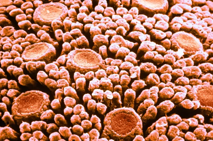 Framed Print : Tastebuds. Color enhanced scanning electron micrograph of taste buds on Framed Print : Tastebuds. Color enhanced scanning electron micrograph of taste buds on